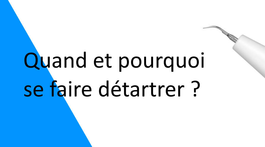 Quand et pourquoi se détartrer ?