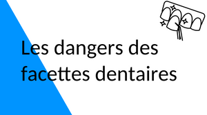 Les dangers des facettes dentaires