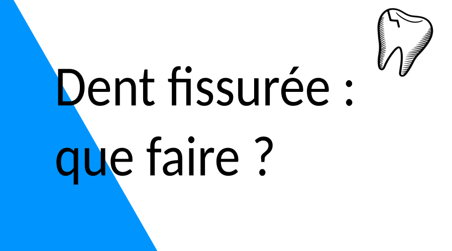 Dent fissurée : que faire ?