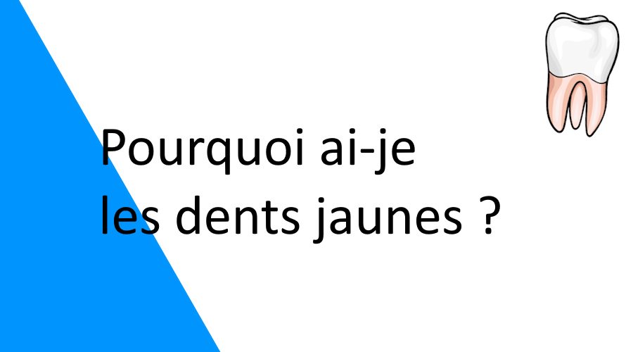 Pourquoi ai-je les dents jaunes ?