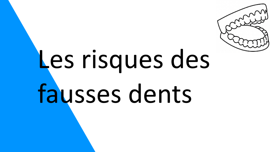 Les risques des fausses dents : ce qu’il faut savoir