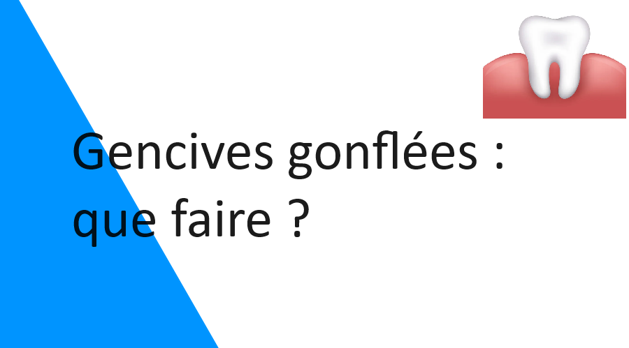 Gencives gonflées : que faire ?