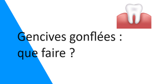 Gencives gonflées : que faire ?