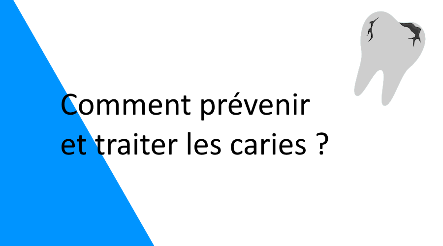 Comment prévenir et traiter les caries efficacement ?